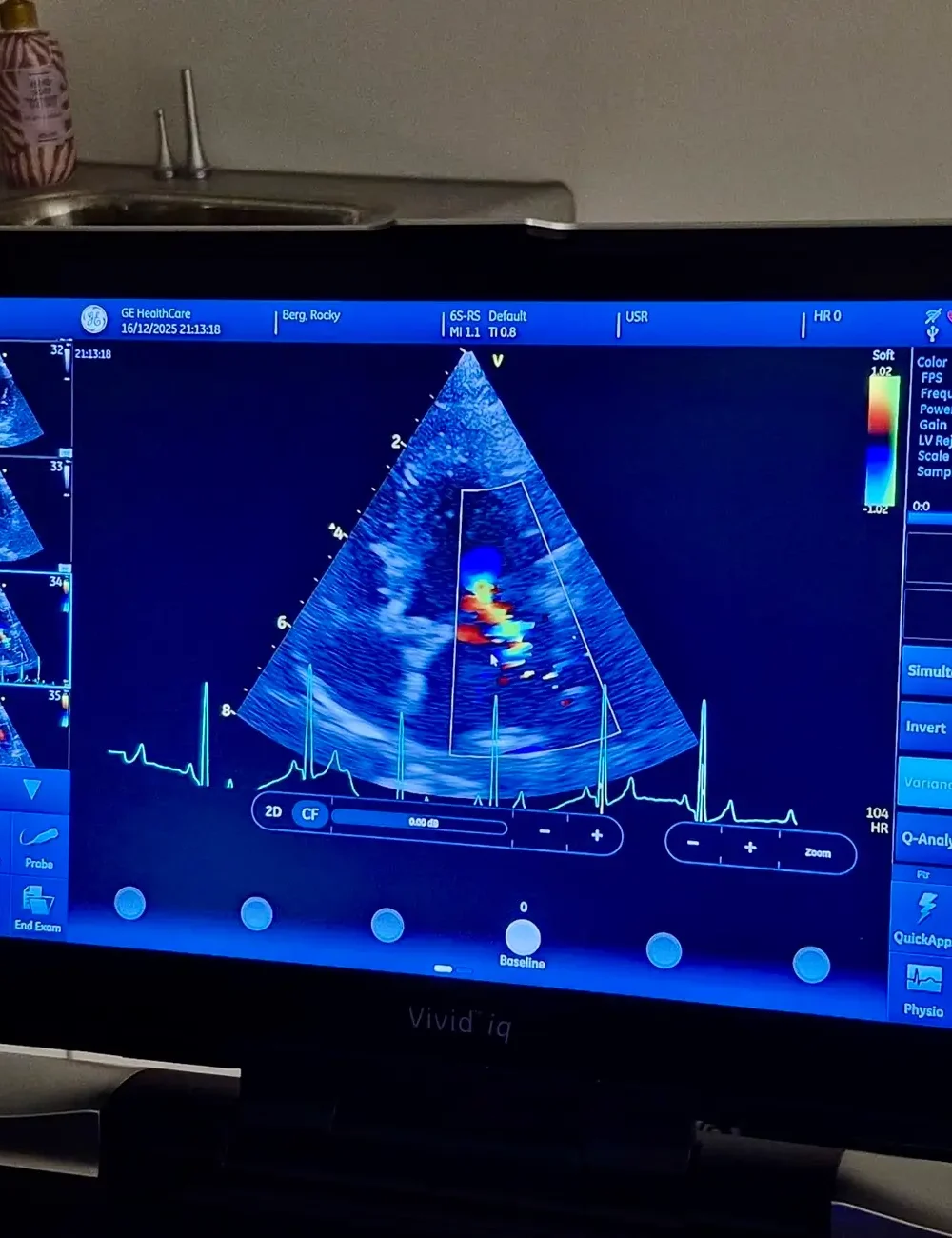 cardiologie dierenarts cardioloog cardiologische consulten